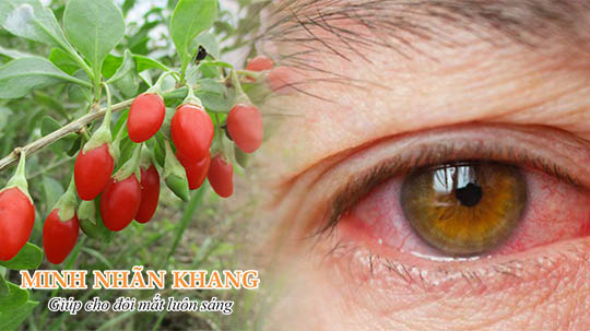 Câu kỷ tử giúp giảm nhanh khô mắt và viêm mắt chỉ sau 1 – 3 tuần