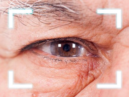 Thay thủy tinh thể có nguy hiểm không