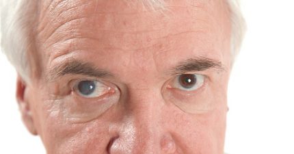 Đục nhân mắt có nguy hiểm không