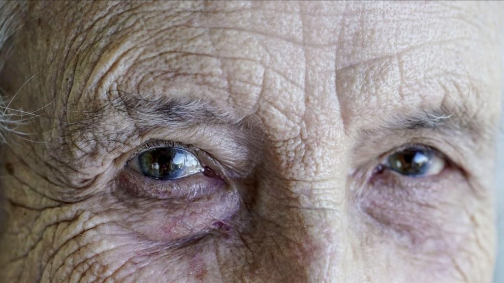 Thay thủy tinh thể bằng phương pháp phaco mắt có thể vẫn mờ