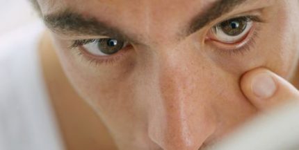 Đục thủy tinh thể do chấn thương khó phục hồi thị lực