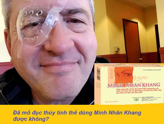 Đã mổ đục thủy tinh thể dùng Minh Nhãn Khang được không