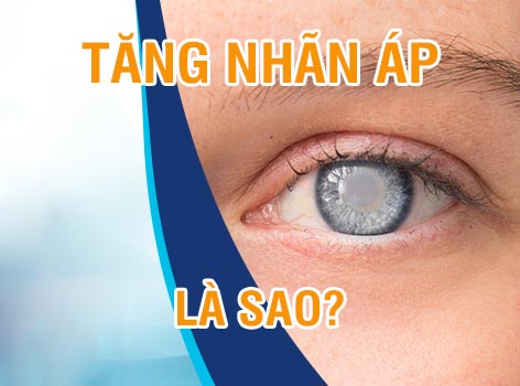 Tăng nhãn áp là sao? Có dấu hiệu cảnh báo trước không?