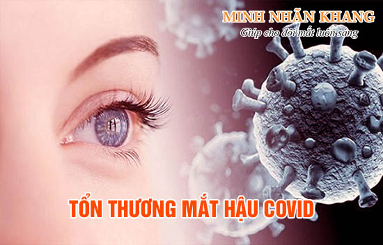 Tổn thương mắt hậu Covid – Cẩn trọng để tránh giảm thị lực nặng